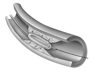 patient_resource_6